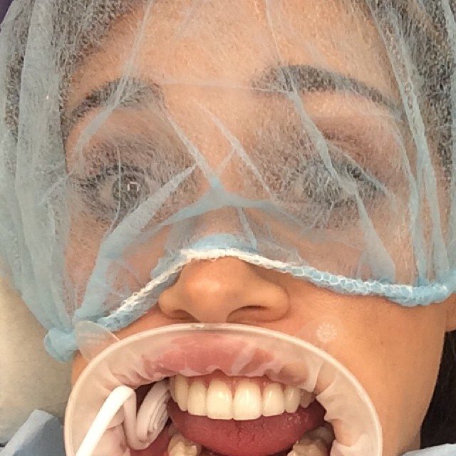 Belen Rodriguez dal dentista | Facebook