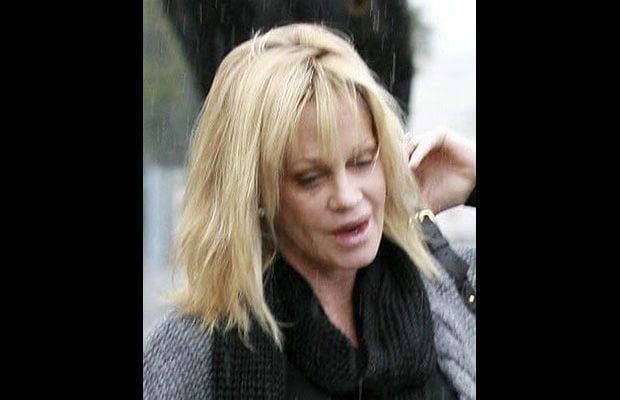 Melanie Griffith fotografata dopo la contusione